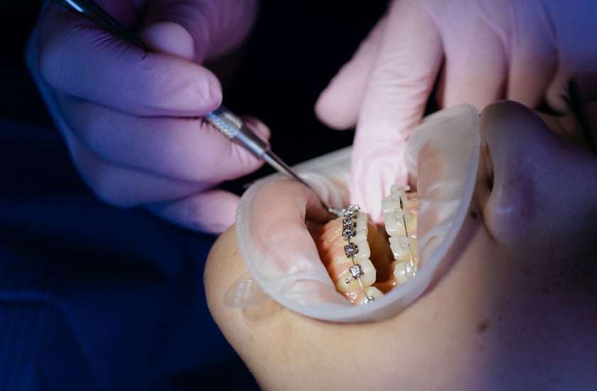 A Complete Guide to Common Types of Dental Services